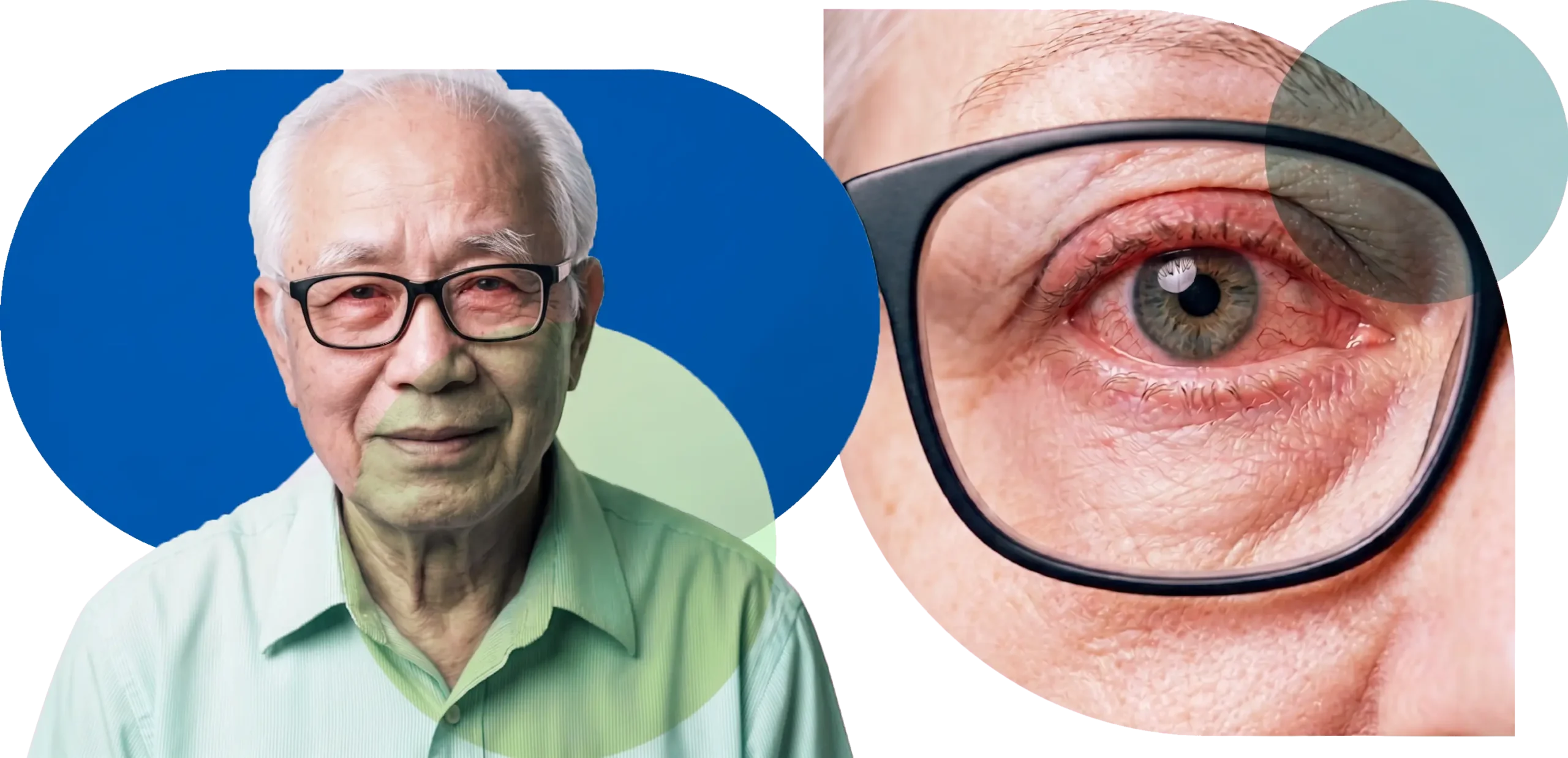 dry eye blog 1 hero